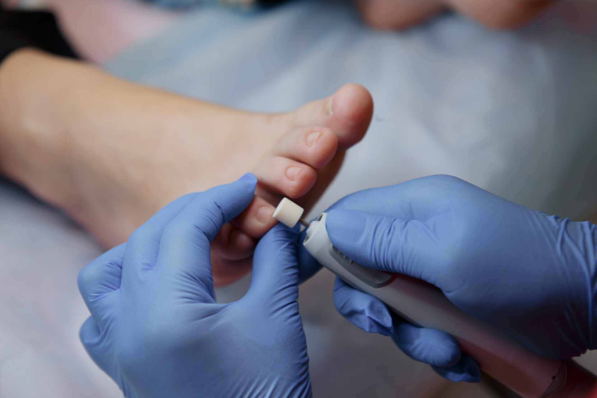 At KT Kent Footcare we offer routine nail cutting, treating cracked heels , and diabetic foot care, I’m here to offer friendly, professional treatment tailored to your needs.