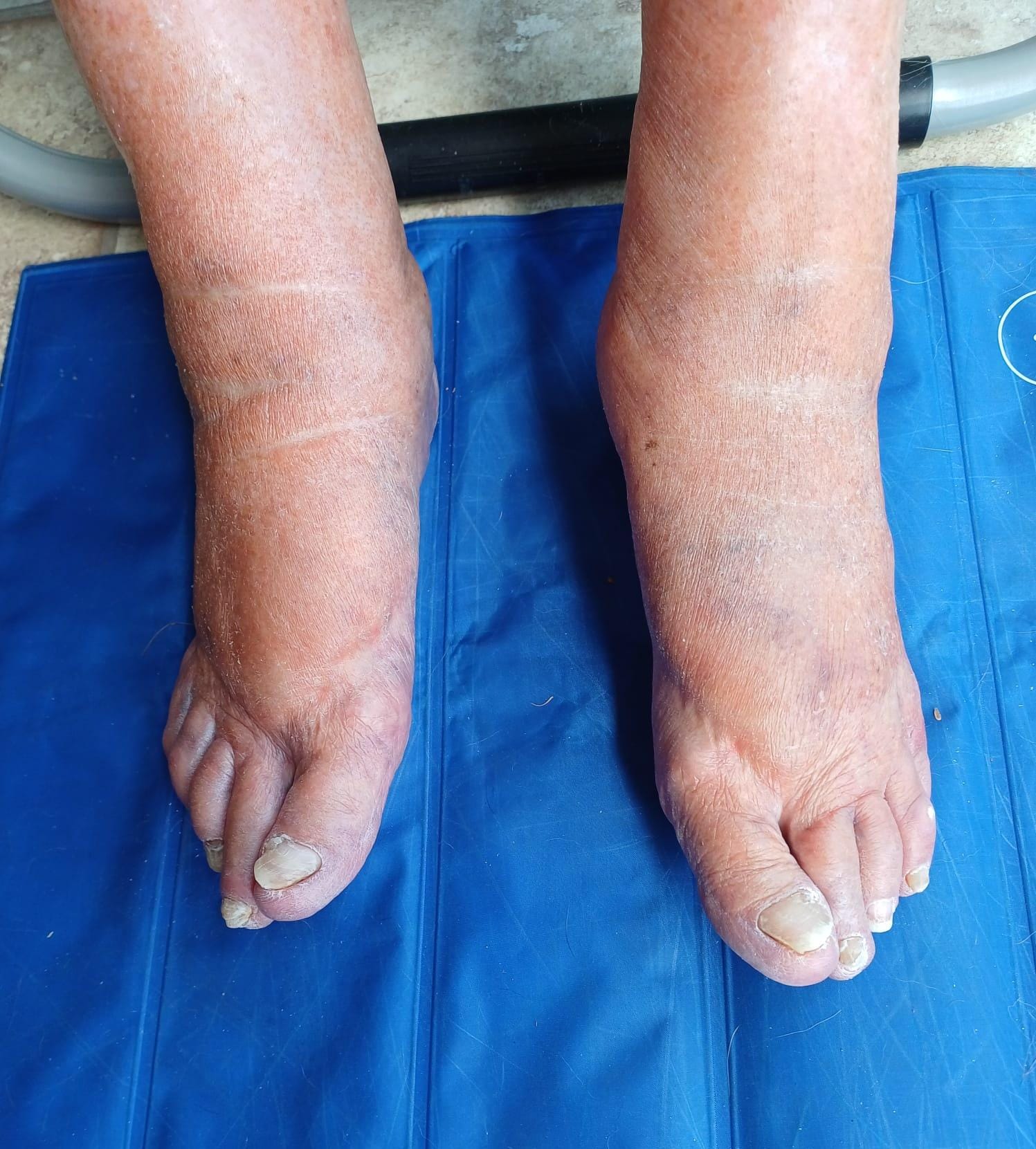 Home visits & footcare - Dartford